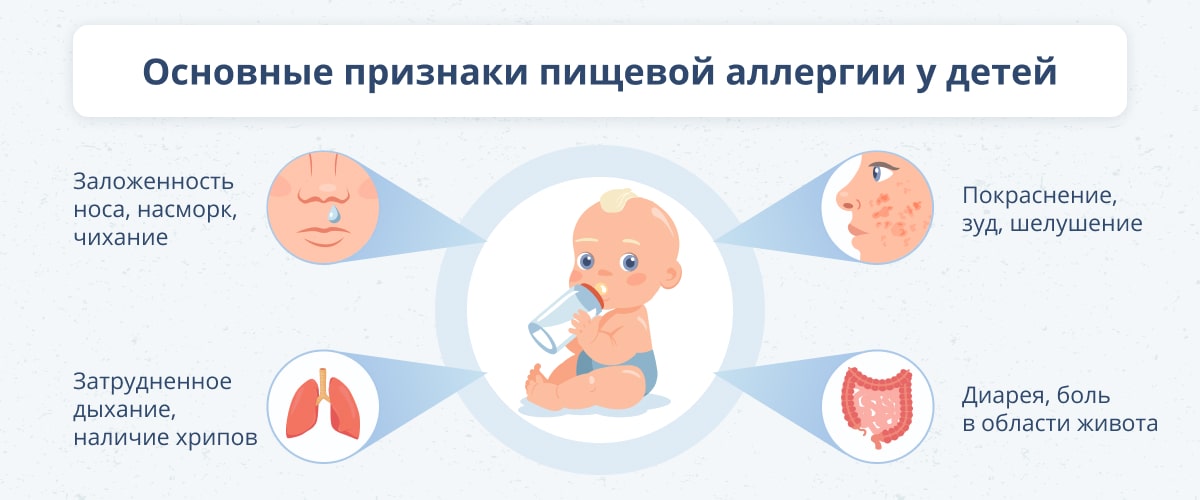 Аллергия у грудного ребенка.</p>
<p>Как предотвратить развитие аллергии?